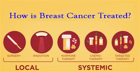 How Is Breast Cancer Treated Dr Abdu
