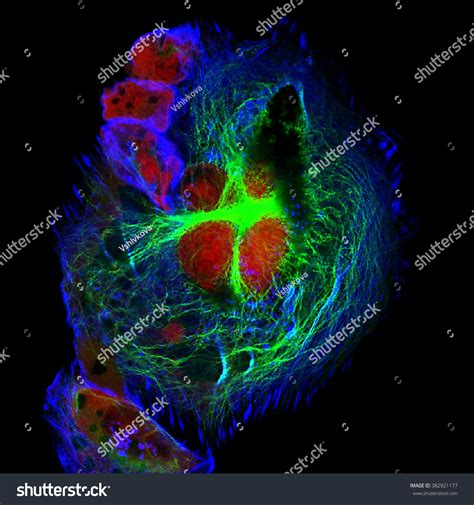 Real Fluorescence Microscopic View Human Neuroblastoma Stock Photo