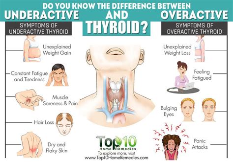 Symptoms Of Overactive Thyroid Problems