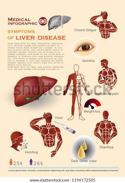 Symptoms Liver Disease Infographic Stock Vector Royalty Free