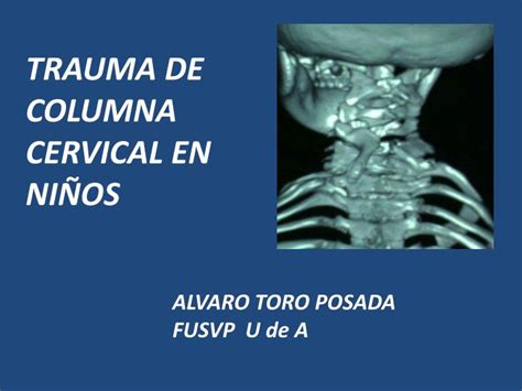 Ppt Trauma De Columna Cervical En NiÑos Powerpoint Presentation Free