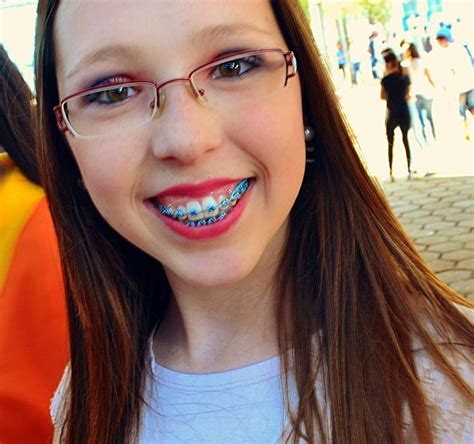 braces girls metal braces teeth whitening lips glasses beautiful quick dental braces
