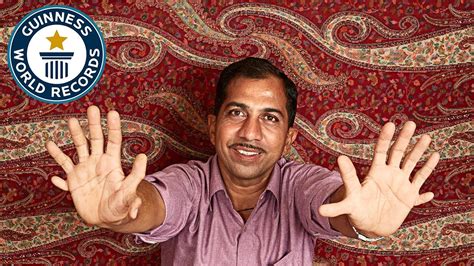 Devendra Suthar The Man With The Most Fingers And Toes Unbelievable