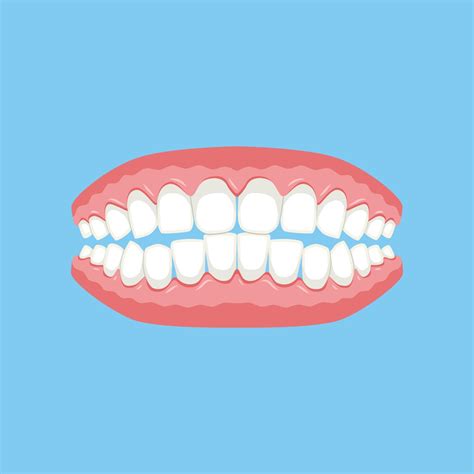 Denture Gums With Teeth Or Dentures Vector Illustration 6599999