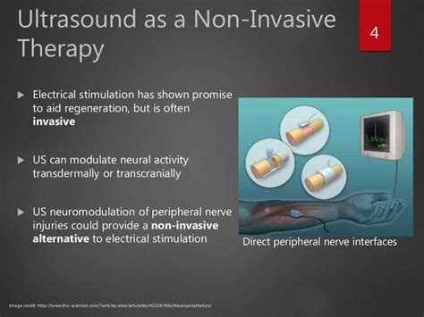 Ultrasound Stimulation For Peripheral Nerve Repair V7