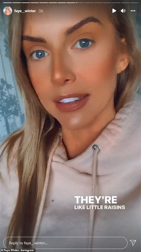 Love Islands Faye Winter Shows Off Her Natural Lips After Getting Her