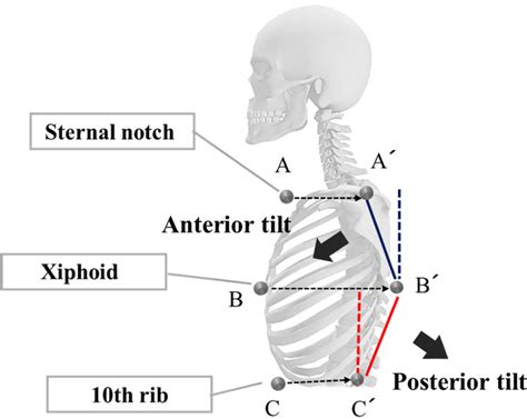 Thoracic Spine Tilt Angles Download Scientific Diagram