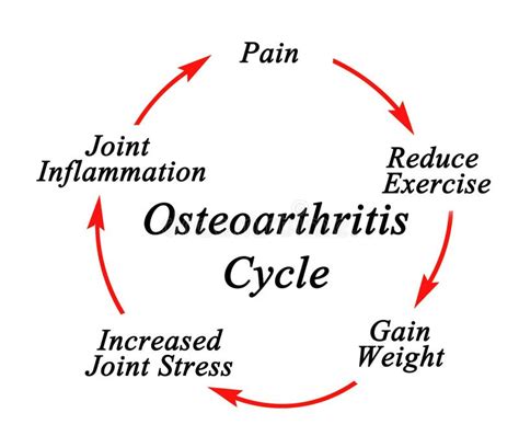 Components Of Osteoarthritis Cycle Stock Illustration Illustration Of