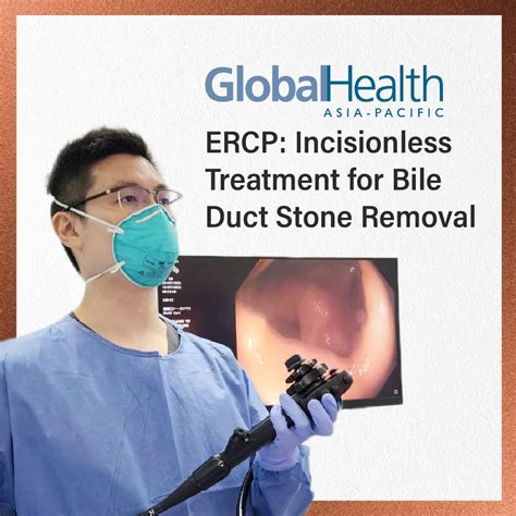 Globalhealth Ercp Incisionless Treatment For Bile Duct Stone Removal