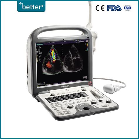 Portable Echocardiography Ultrasound Scanner S8 China Echo And Pregnancy