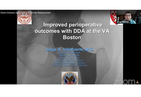 Direct Anterior Approach In Total Hip Replacement