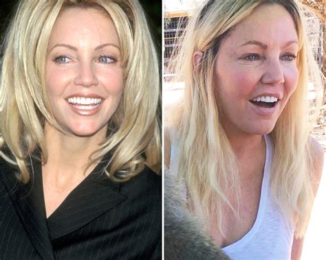 Has Heather Locklear Gotten Plastic Surgery Our Experts Exclusively