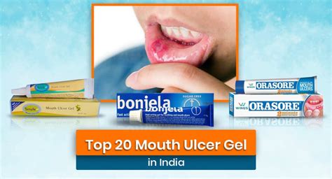 Top 20 Mouth Ulcer Gel In India Price Uses Best Treatment