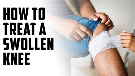 how to treat a swollen knee a episode 117 youtube