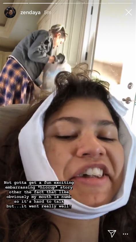 Zendaya Updates Fans With Funny Videos After Getting Her Wisdom Teeth Out Photo 1208361