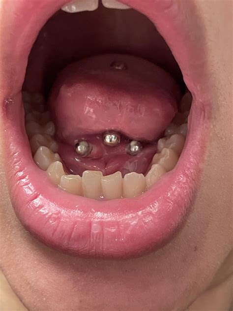 is my 2 year tongue web piercing infected r piercing