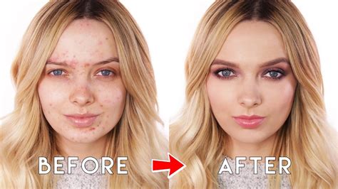 Airbrush Makeup Acne Before And After Saubhaya Makeup