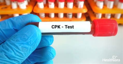CPK Test: Purpose, Results & Preparation - HEALTHIANS BLOG
