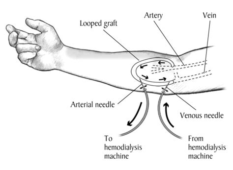 How To Get Veins To Show In Forearms