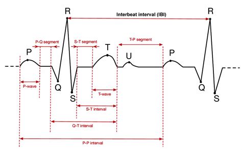 Ecg Of Normal Sinus Rhythm Infographic Diagram Showing Normal Heart