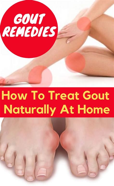 Gout Remedies How To Treat It Naturally At Home Gout Remedies Home