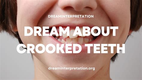Dream About Crooked Teeth Interpretation And Spiritual Meaning