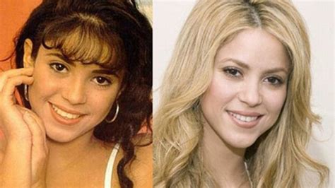 El Antes Y El Después De Shakira Más De 63000 Euros En Retoques Estéticos
