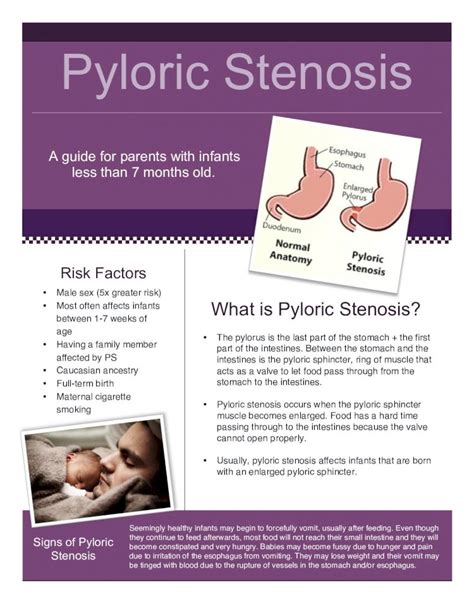 Pdf Pyloric Stenosis Patient Information Guide€¦ · • Pyloric Stenosis