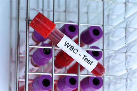 Wbc Test To Look For Abnormalities From Blood Stock Image Image Of
