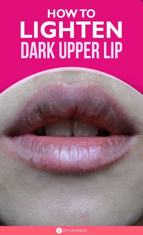 How To Lighten Dark Upper Lips Naturally Upper Lip Lip Lightening Lips