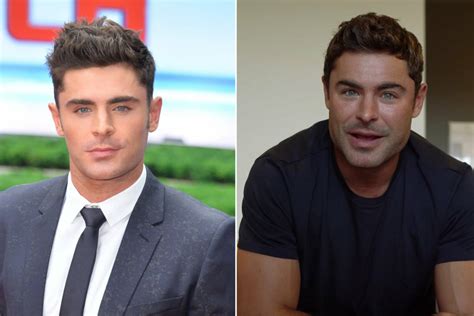 zac efron s radical transformation leaves many wondering if he s had plastic surgery
