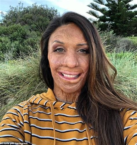 Tammin Sursok Is Set To Play Burns Survivor Turia Pitt In A Biopic Daily Mail Online