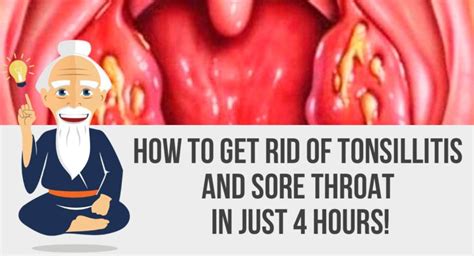 How To Cure Tonsillitis And Sore Throat In Only 4 Hours Healthy Food