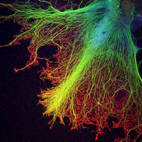 7,291 likes · 9 talking about this. Neurons growing over astrocytes in a human stem cell ...
