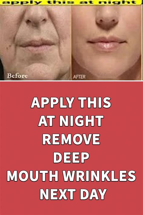Apply This At Night Remove Deep Mouth Wrinkles Next Day Mouth