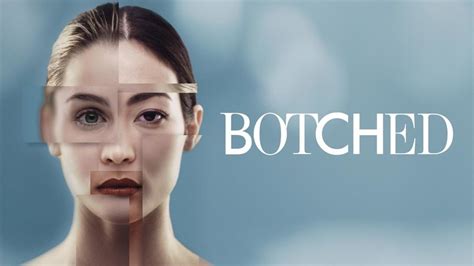 Botched · Serie Im Stream Online Ansehen Alle Anbieter Und News