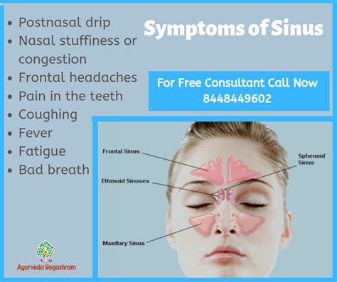 80 Best Of What Are The Symptoms Of Ethmoid Sinusitis Fulton Free