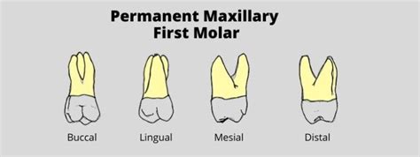 Permanent Maxillary First Molar Tooth Morphology Made Easy