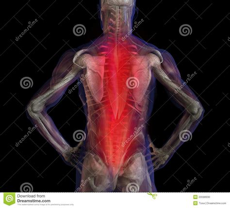 This is the best guarantee in back care. X-ray Illustration Of Male Human Back Pain Pain. Stock ...