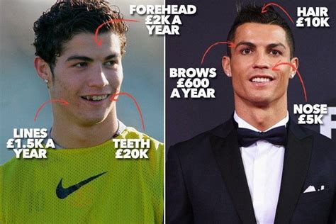 Cristiano Ronaldo S Looks Enhanced By Surgery