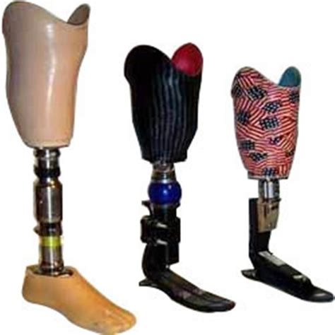 Below Knee Prosthesis Artificial Limbs कृत्रिम अंग In Gujarat Gas