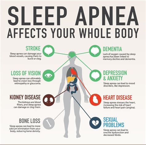 Sleep Apnea A Quiet Crisis For Brain Health What You Need To Know