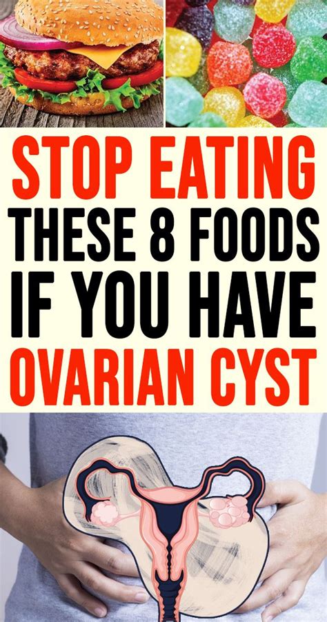 Stop Eating These 8 Foods If You Have Ovarian Cyst Ovarian Cyst