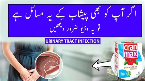 Uti Infection Treatment In Urdu Peshab Ki Jalan Ka Ilaj Uti Youtube
