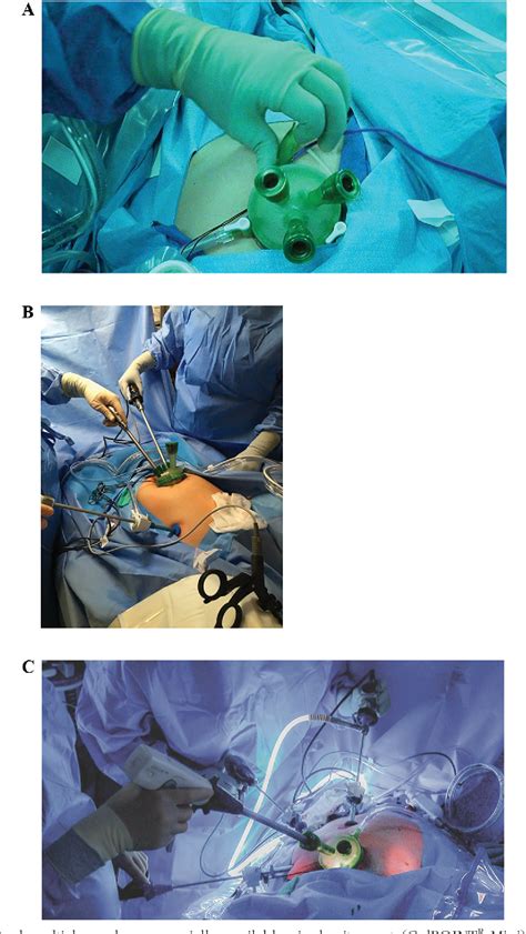 Figure From Vaginal Natural Orifice Transluminal Endoscopic Surgery Revolution The Next