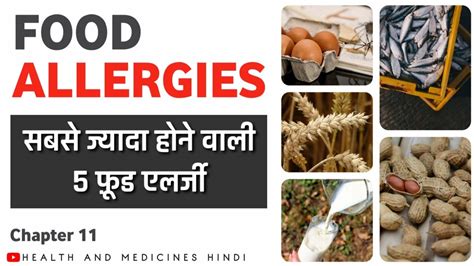 5 Most Common Food Allergies Food And Allergies फ़ूड एलर्जी हिन्दी में Youtube