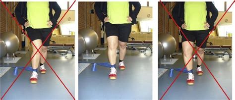 Dynamic Valgus Instability Of The Knee Due To Chronic Medial Collateral