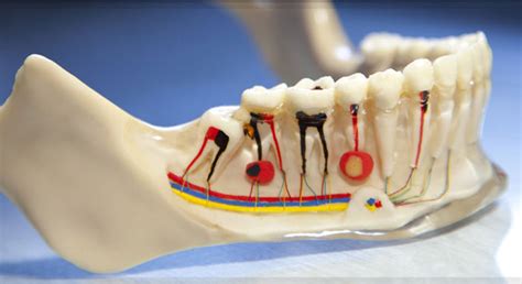 If you catch a tooth in the early stages of dying, you have a chance to save the external tooth structure. Affordable Root Canal Treatment & Therapy in Costa Rica