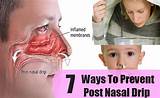 Images of Post Nasal Drip Therapy
