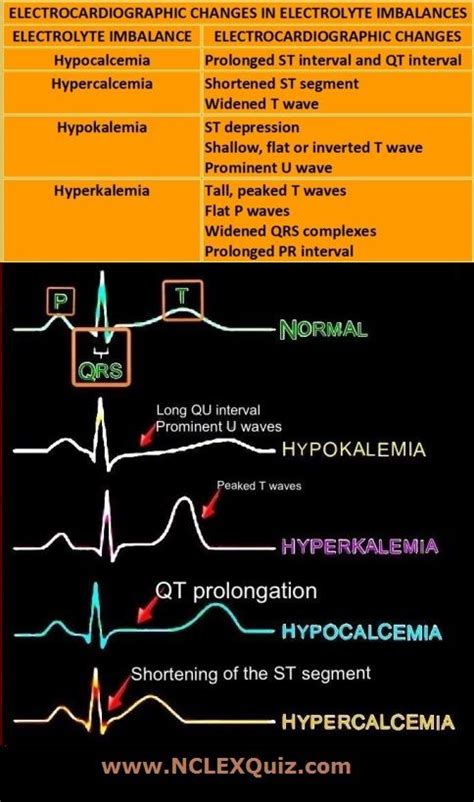 EKG Changes In Electrolyte Imbalances NCLEX Quiz Cardiac Nursing Electrolytes Imbalance